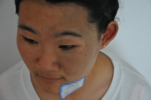 女生胎记两千元,胎记女生