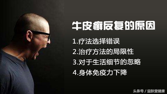 寻找牛皮癣的病根，几十年不愈的原因在哪里，专家指出关键