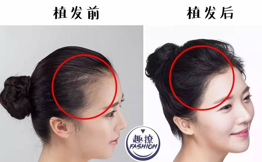 拯救进口小哥迪玛希，我想要他的同款高发际线！