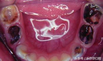 牙疼到底算什么样的一种病,牙疼到底是不是病