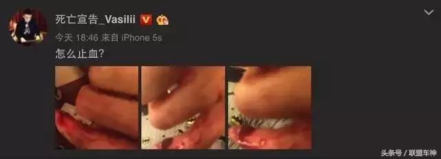 姝讳骸瀹ｅ憡涓哄暐杩欎箞鑳芥墦,姝讳骸瀹ｅ憡50婊磋缈荤洏