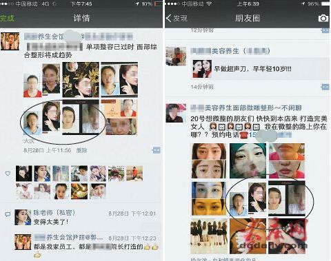 朋友圈内的整形工作室很恐怖，别再被坑了