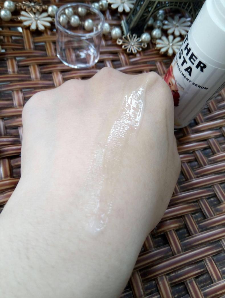 皮肤又干又黄用什么护肤品,皮肤又黄又干怎么办