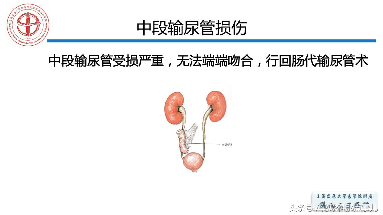 泌尿男科王忠教授,泌尿外科专家王忠教授
