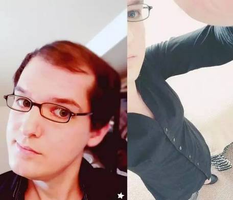 男人服用大量雄性激素会怎么样,男生长期服用雌性激素会怎么样