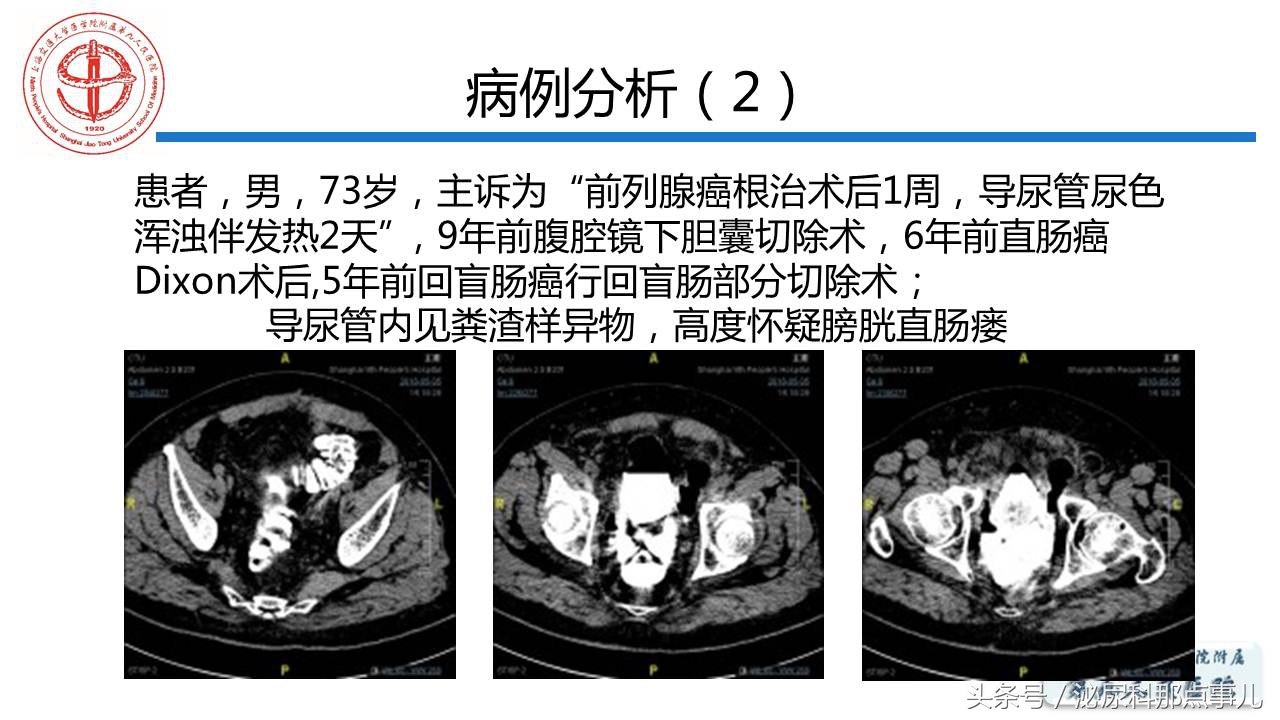 泌尿男科王忠教授,泌尿外科专家王忠教授