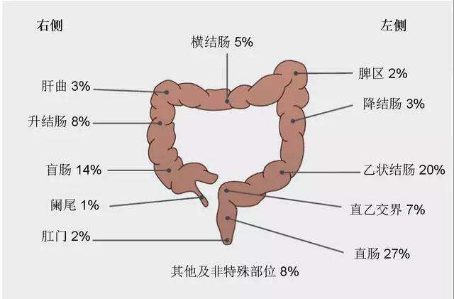 饮食方面该如何防治肠癌,千万不要吃的癌症食物