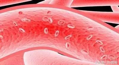 颈动脉堵塞会引起呼吸困难吗,颈动脉血管堵塞60%严重吗