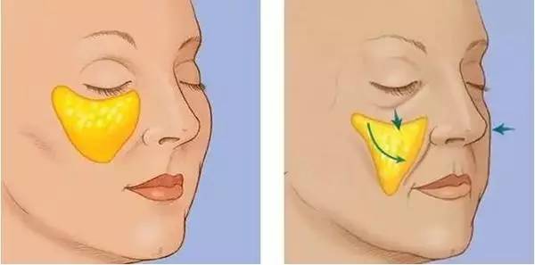 新垣结衣怎么那么像中脸型,为什么新垣结衣傻白甜得这么可爱