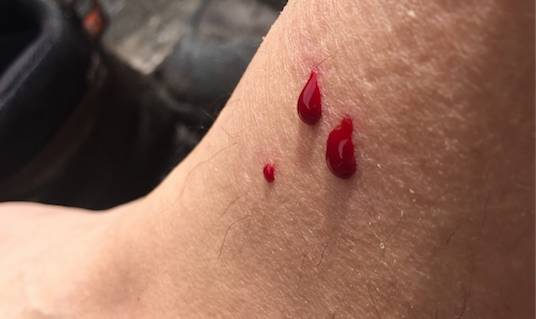 不被蚂蟥咬一次，怎能算走过墨脱｜徒步墨脱大结局