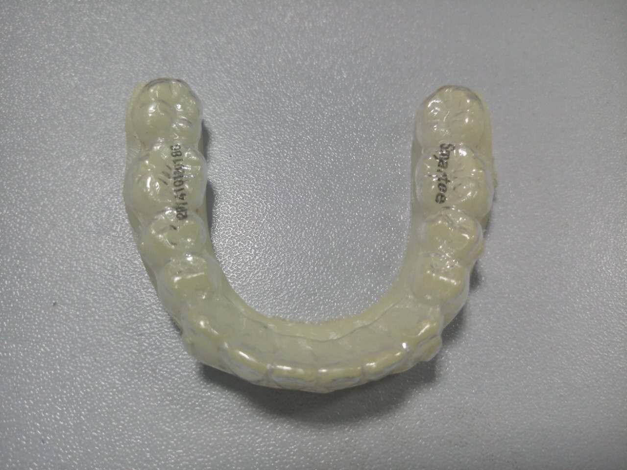 隐形牙套整牙全过程介绍,拔掉四颗牙隐形牙套矫正的全过程