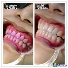 一碰凉水就胃疼,大牙一碰冷热酸甜就疼