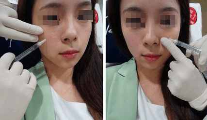 鐜诲翱閰稿埌搴曡兘涓嶈兘澶氭墦,鎵撶幓灏块吀鍒板簳鏈夊鐥涜嫤