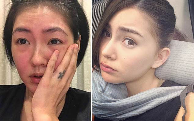 过敏皮肤红怎么化妆好,擦化妆品脸过敏发红怎么快速解决