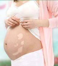 治疗白癜风期间可以怀孕吗,白癜风怀孕有什么症状