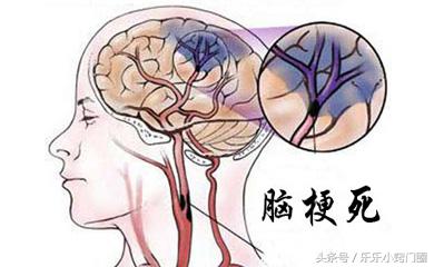 三七对脑梗塞功效与作用,脑梗塞吃药可以吃三七吗