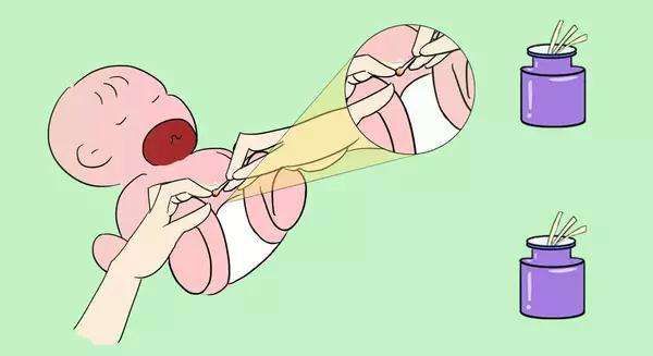 肚脐眼里的泥又多又硬能不能抠,肚脐眼的泥抠下来有什么事