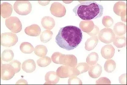 外周血细胞涂片的正常值,外周血细胞分析多长时间出结果