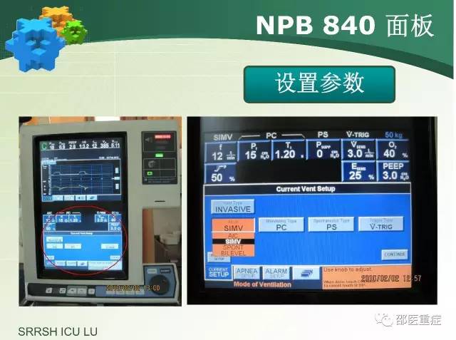 有创机械通气操作,机械通气英文缩写