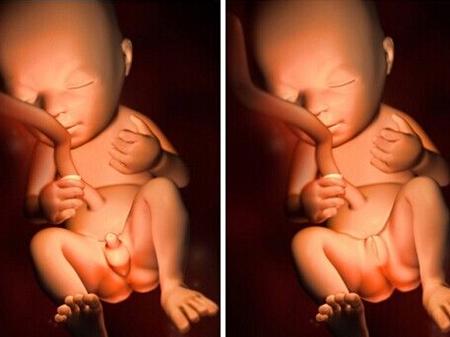 医生不能说的秘密！四维彩超怎么分辨男女？