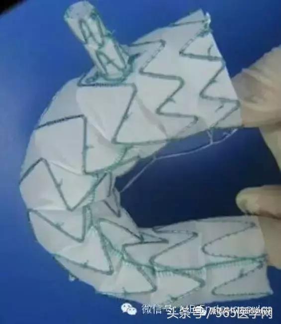 胸主动脉瘤保守治疗的方法,江西省胸科医院黄建华