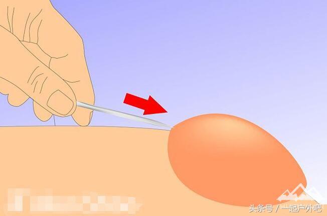 徒步如何避免起水泡,徒步怎么防止脚打泡