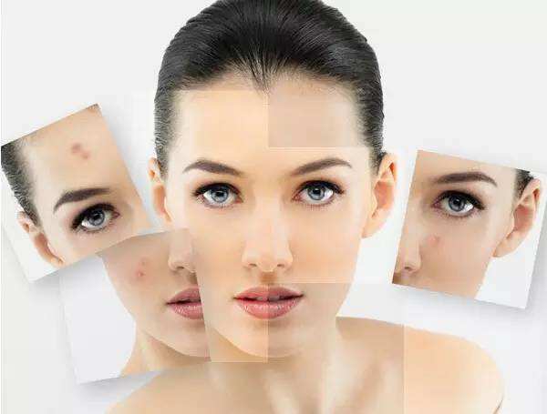 痘痘消了留下的印记怎么消,身上长痘痘留下的痘印怎么去除