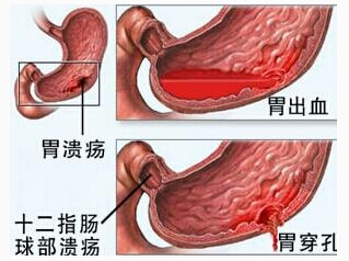 饮酒后的表现,喝酒后哪些不适属于正常