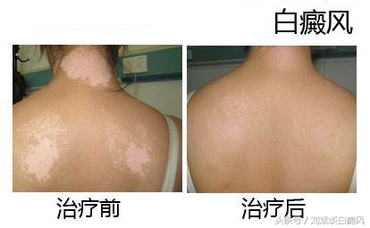 不要自己吓自己的图片,不要自己吓自己人生感悟