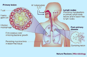 全民防治结核病,社会防治结核宣传活动
