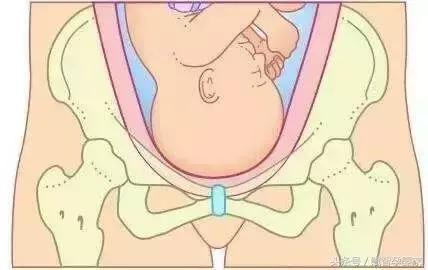 怀孕后期压力很大后悔了怎么办,怀孕后必知的8个真相