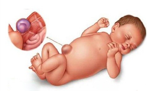 小宝宝的小肚脐,宝宝肚脐护理可别大意了