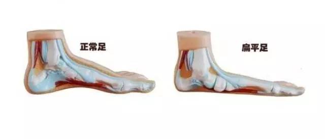 小腿结构图示图片,小腿骨骼构造示意图