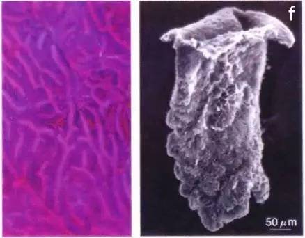 普通内镜与Pitpattern分型（多图详解）