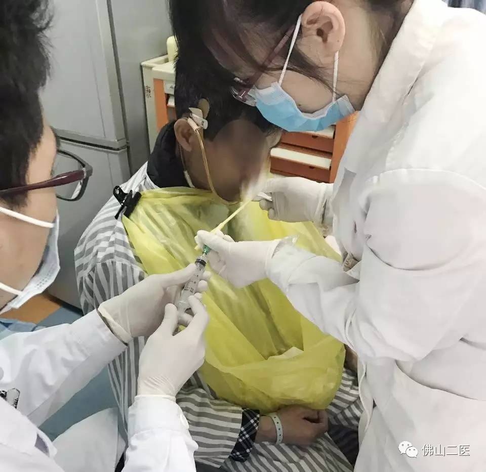 吞咽障碍食管球囊扩张技术作用,吞咽障碍导尿管球囊扩张术