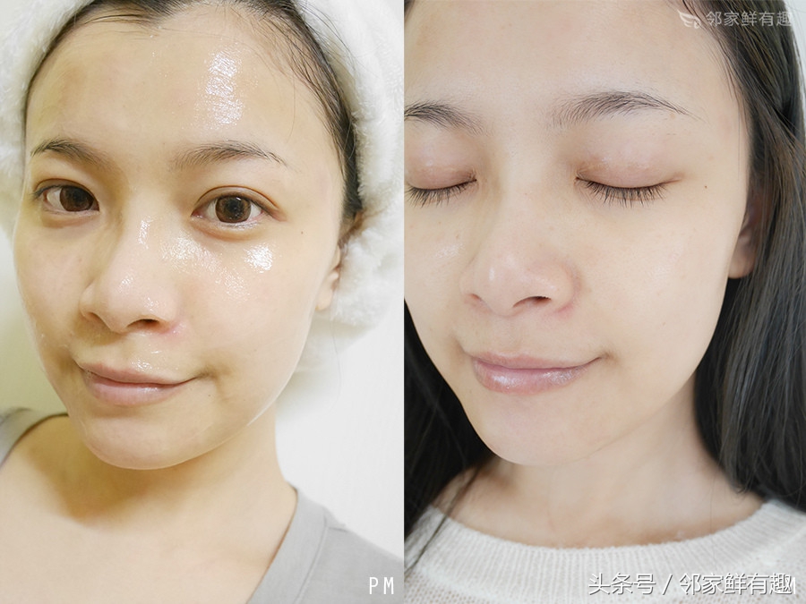 消灭敏感泛红皮肤，玻尿酸让你清爽一整个春夏