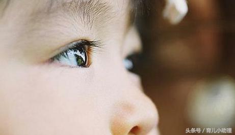 宝宝总是揉眼睛有红血丝怎么办,宝宝眼睛红血丝严重怎么办