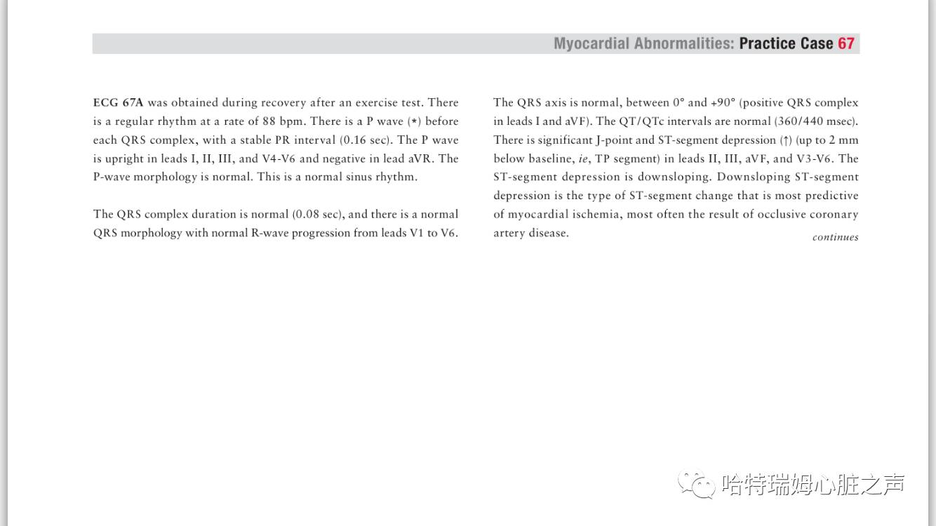 读心有术视频讲解,长期心电图提示下壁st段轻度压低