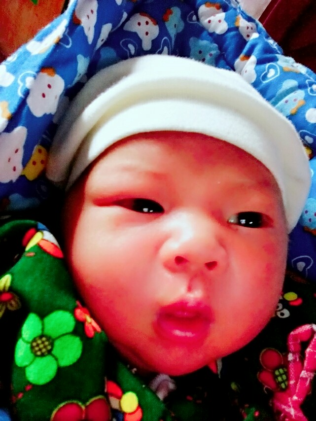 积液和褐色分泌物给我滚蛋,胎盘低的我最终还是保胎成功