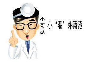 怎么判断自己得了痔疮外疮,怎么判断是不是外痔疮