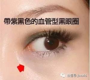 你的黑眼圈怎么去的,4招教你缓解黑眼圈远离熊猫眼