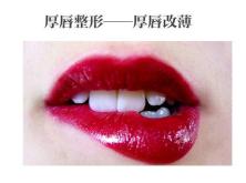 改善不完美的唇型,怎样的唇型是完美唇型