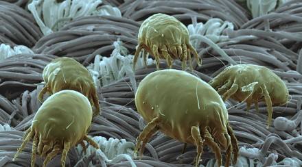 身体周围有螨虫,总觉得到处有螨虫怎么办