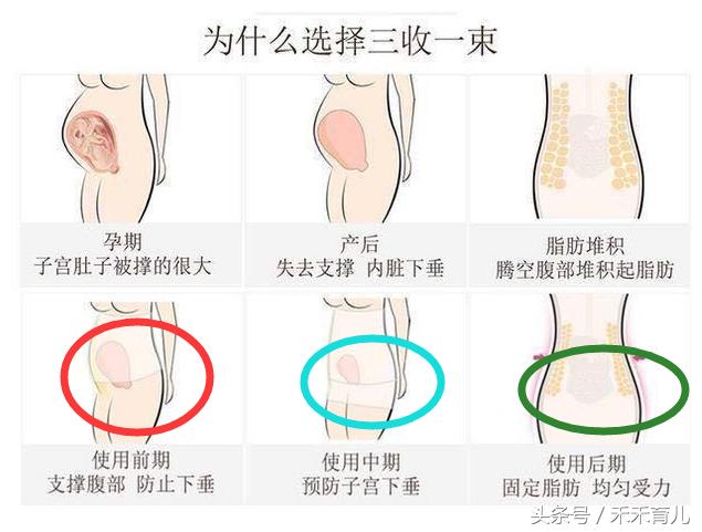 产后收腹带你用对了吗,到底有没有必要用产后收腹带