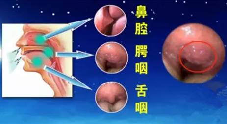 男子因打鼾呼吸暂停而死亡,男人喝醉酒打呼噜憋气视频