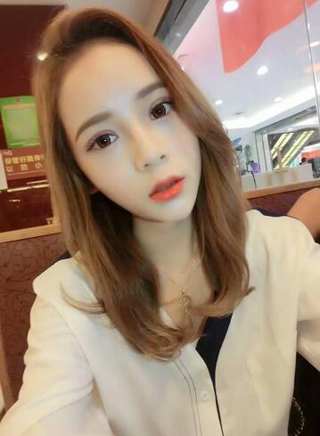 韩式三点定位恢复图片,韩式三点双眼皮恢复一个月图片