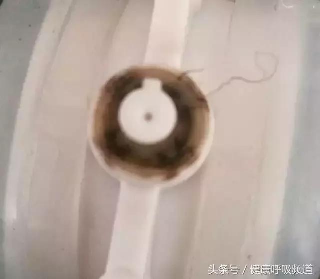 慢阻肺肺气肿的最佳治疗方法,肺气肿买什么样的呼吸锻炼仪好