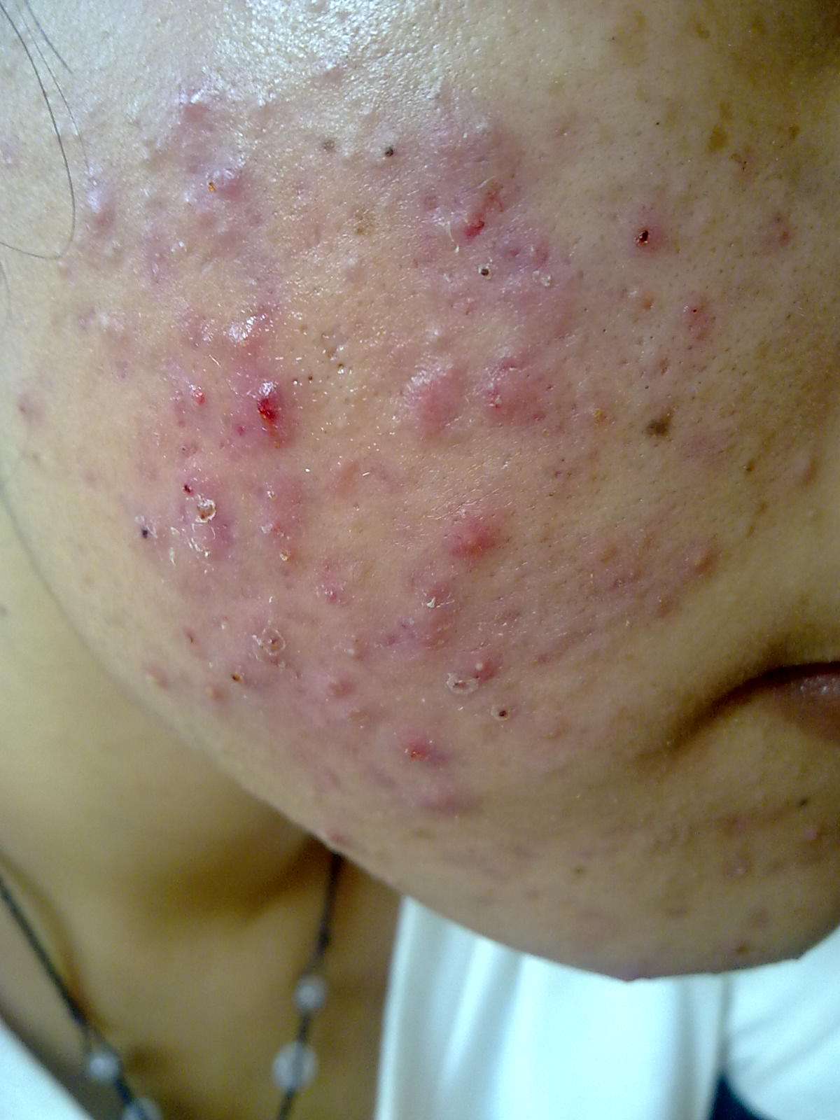 她来姨妈痛怎么办,她来姨妈了怎么办