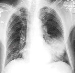 医疗故事病患,医患治病的故事