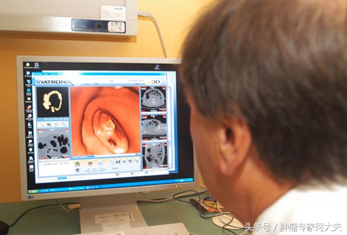 食管癌筛查与早诊早治指南,胃癌肠癌早期筛查